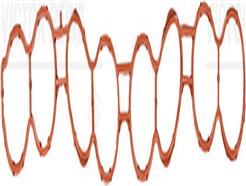 VICTOR REINZ 71-15701-00